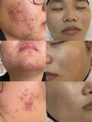 点击看大图 -skin79皮肤管理基站