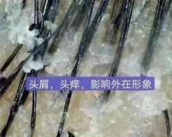 -肤原祛痘修肤中心