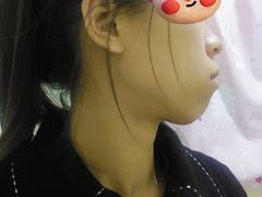 -极光口腔·矫正种植修复(锦江店)