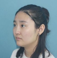 -深圳悦她医疗美容