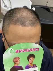 -唐风采假发补发定制