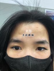 体验前-上海宏康医院·医疗美容科