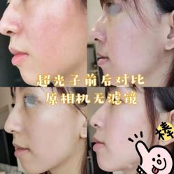 -海涛医疗美容·面部抗衰·注射美鼻