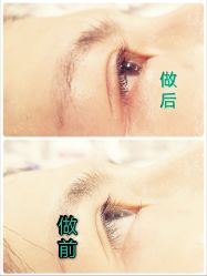 -樱木町·日式头皮管理中心