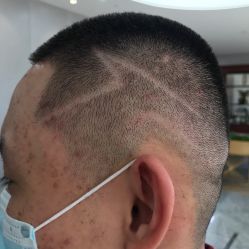 -聚美荟科技护肤