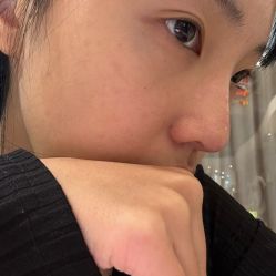 -柠檬一美·Ondapro·轻薄紧致抗衰中心