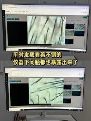 -雍禾植发全国连锁