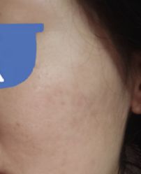 -西安伊美尔医疗美容医院