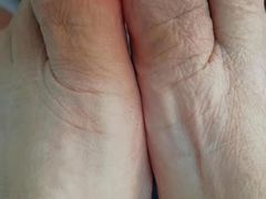 -世龙世家灰指甲鸡眼脚气甲沟炎跖疣护理(通州店)