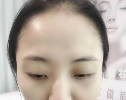-MIVI半永久纹眉绣眉