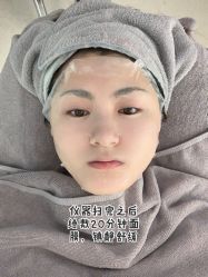 体验后-纯粹医美