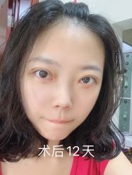 -八大处整形