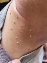-苗方清颜专业祛痘连锁机构