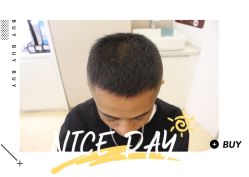 -大麦微针植发全国连锁