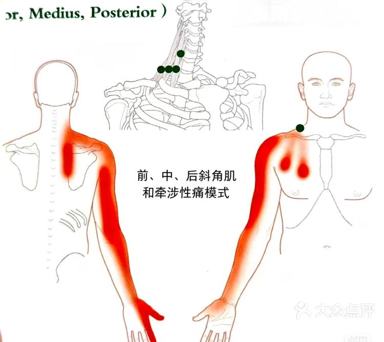 胳膊到手的详细图图片