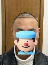 -大麦微针植发全国连锁