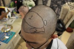 -大麦微针植发丨全国连锁