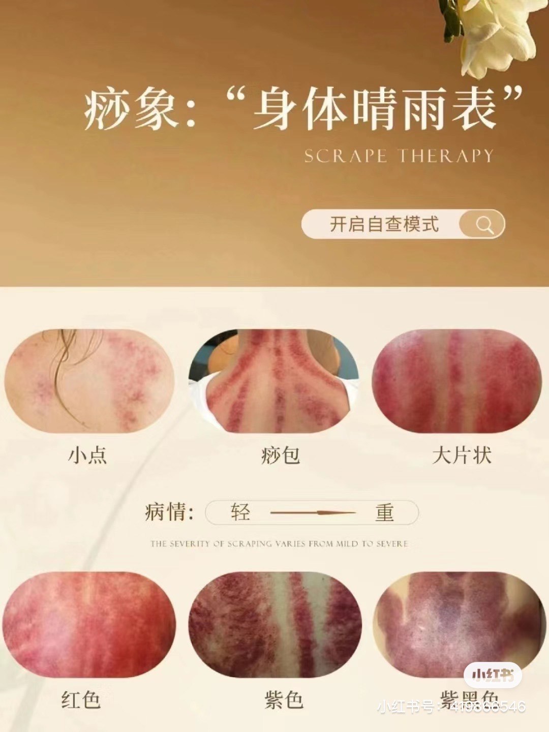 刮痧后的颜色可以反映出一些身体状况