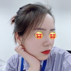 点击看大图 体验后-上海星和医疗美容