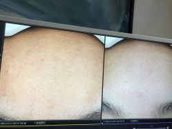 -苑苑vbeauty科技美容SPA