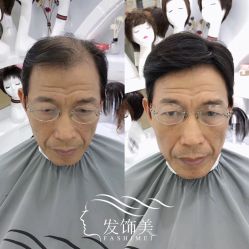 -发饰美男士增发补发假发定制店