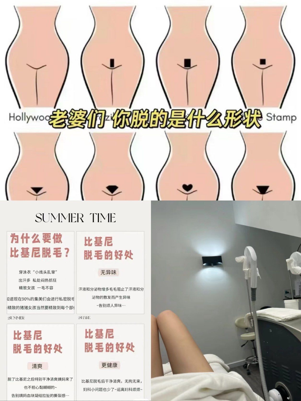 比基尼脱毛太香啦