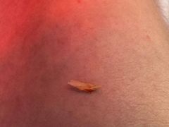 -新甲连锁灰指甲·甲沟炎·鸡眼(黑龙江路店)