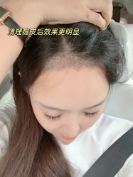 -雍禾植发全国连锁