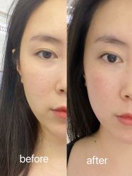 体验前-圣嘉新医疗美容医院