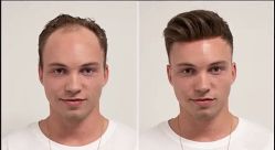 -发饰美男士增发补发假发定制店