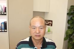 点击看大图 -大麦微针植发丨全国连锁