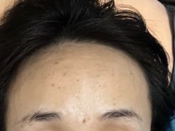 体验后-苏州卫康美容医院