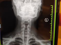 -杭州市第一人民医院(湖滨院区)