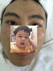 -痘博士北京·全国连锁祛痘机构