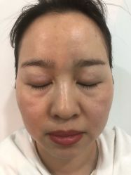 -黎蓓露·徒手骨雕蛋白抗衰·调肤管理