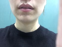 体验前-美丞医疗美容