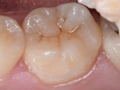 -新达口腔(华东理工大学店)