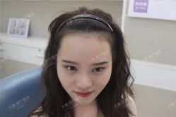 点击看大图 -大麦微针植发丨全国连锁