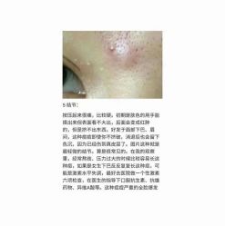 -美肤盾祛痘·问题肌头疗管理中心