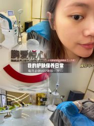 体验后-深圳鹏爱悦心医疗美容医院