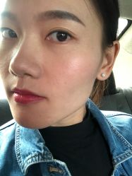 -蕾特恩专业祛痘国际连锁