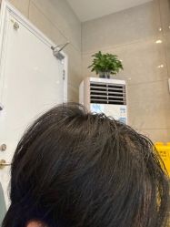 -碧莲盛·不剃发植发