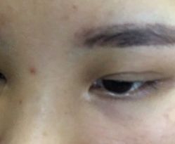 点击看大图 -贵阳美莱医疗美容整形医院