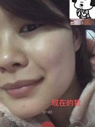 -素妍印象Ekrin Medi Clinic