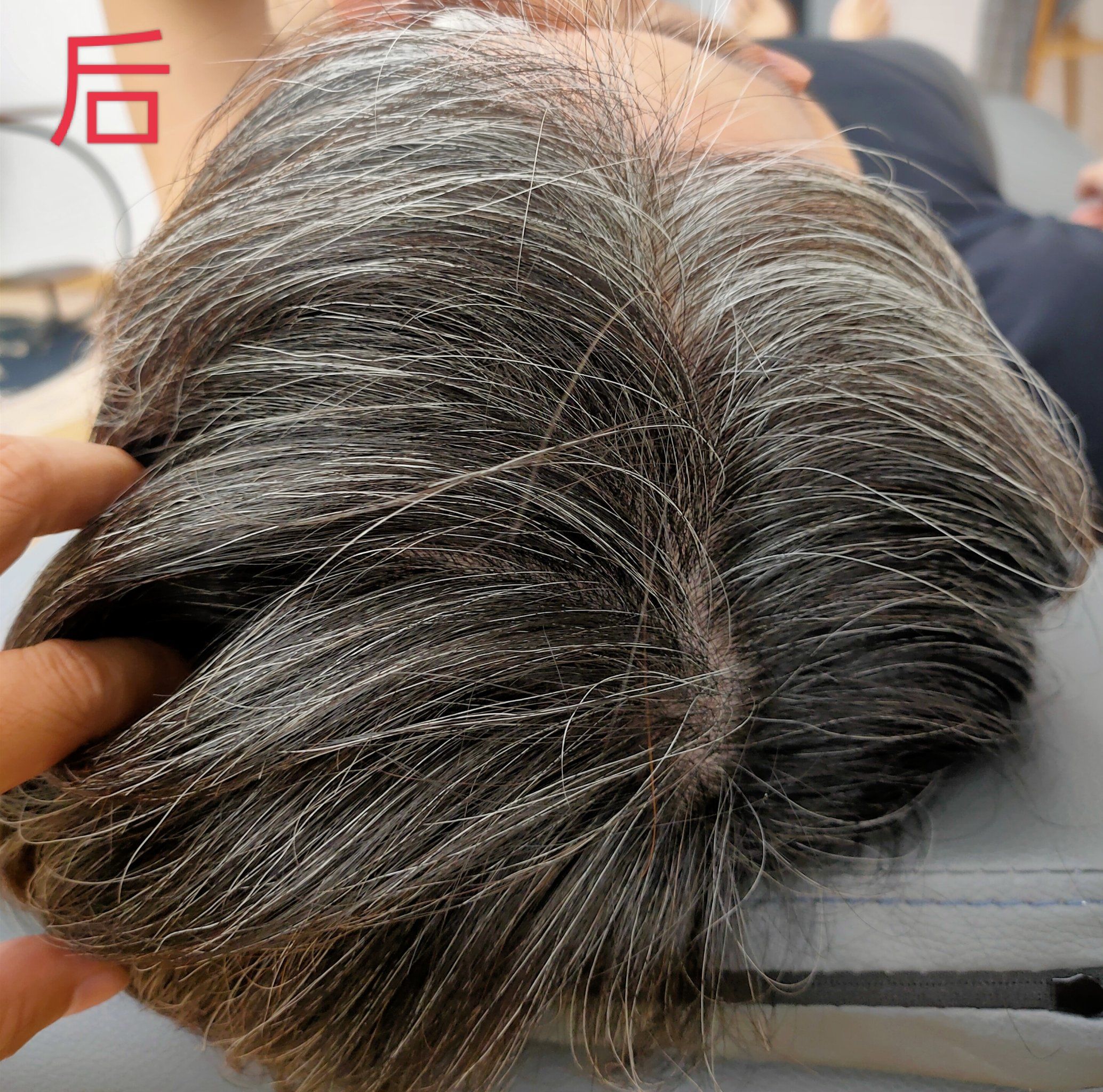 为什么白发是卷的?百科在线