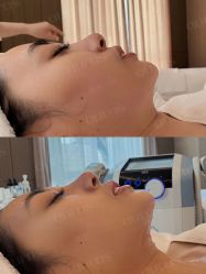 点击看大图 -AURAS璈然科技护肤中心