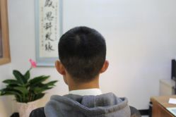 -大麦微针植发丨全国连锁