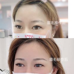 点击看大图 -Verywang半永久纹眉•仪器野生眉