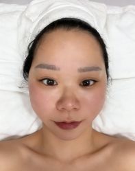 -蕾特恩专业祛痘国际连锁