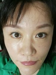 -广东韩妃整形外科医院